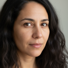 Before - I'm totally blown away by my skin!